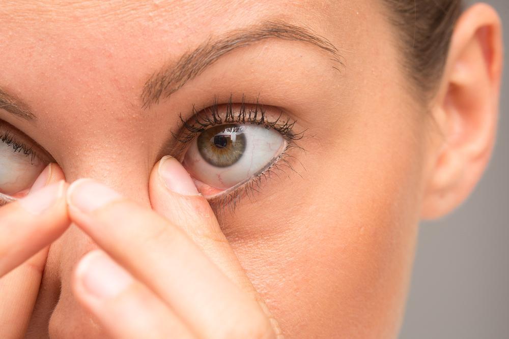 Why You Should Never Pop That Red Tender Bump Near Your Eye