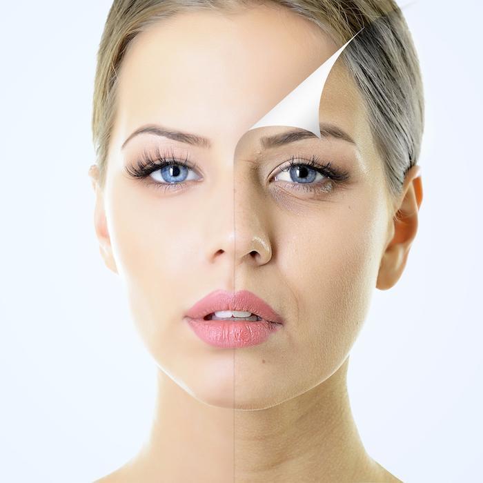 What Can a Chemical Peel Do?