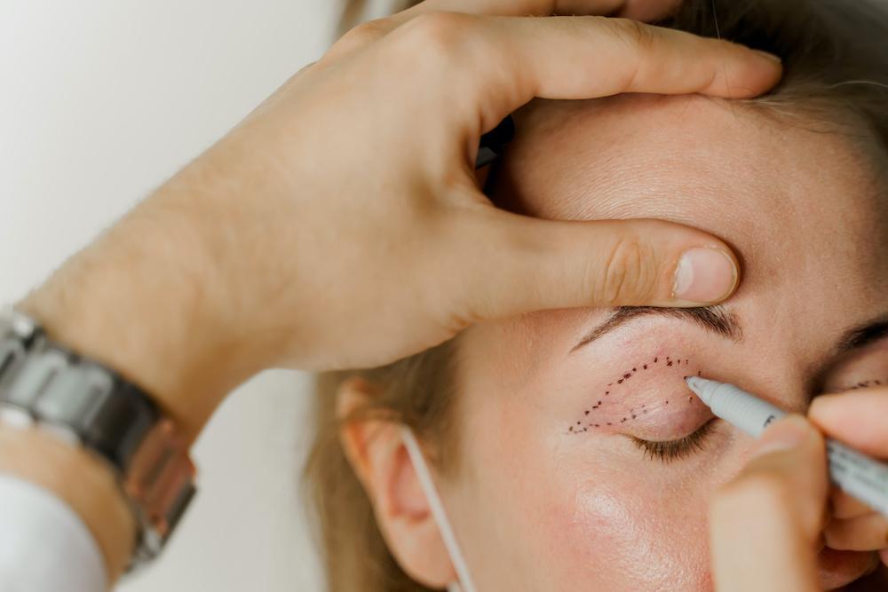 What Causes an Inverted Eyelid?