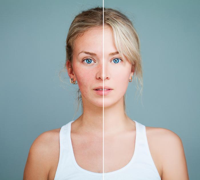 Revitalize the Skin You're in with DiamondGlow Noninvasive Skin Resurfacing